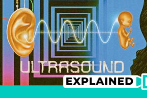 Ultrasound Movie: Explained (Plot And Ending)
